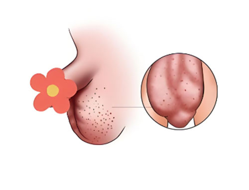 睾丸上长一个小疙瘩是怎么回事