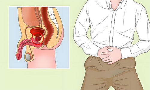 前列腺增生的原因是什么引起的