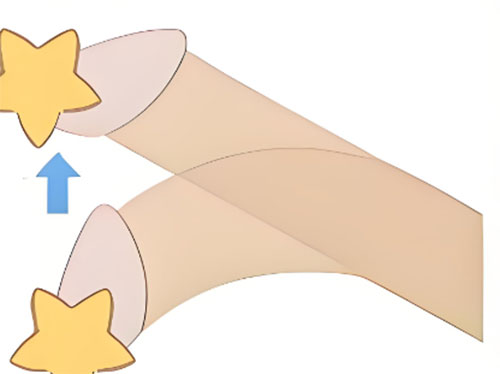 丁丁往左偏了怎么办