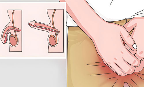 丁丁是弯的怎么可以矫正