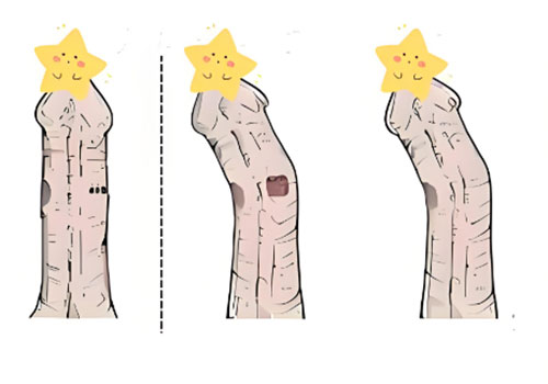 丁丁向左歪的厉害怎么办