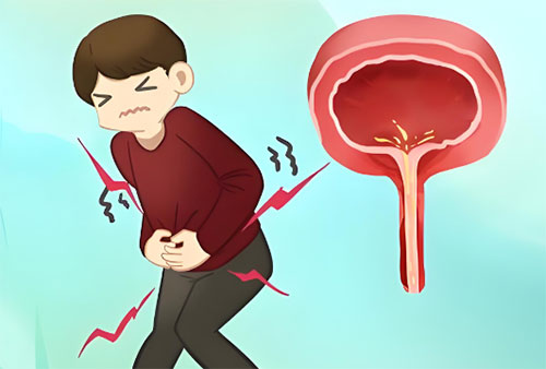 男人尿道炎吃什么药好