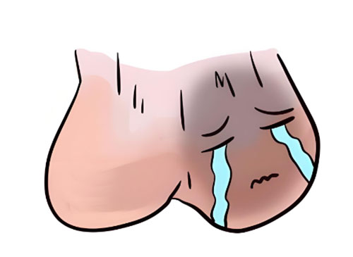 睾丸疼痛什么原因