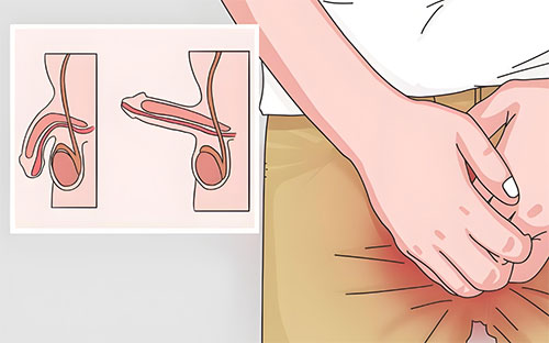 丁丁为什么向左歪