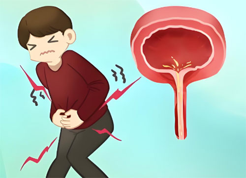 男性尿道炎吃什么药