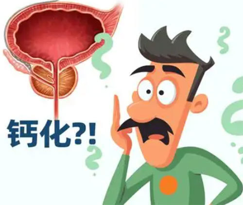 前列腺钙化有什么后果