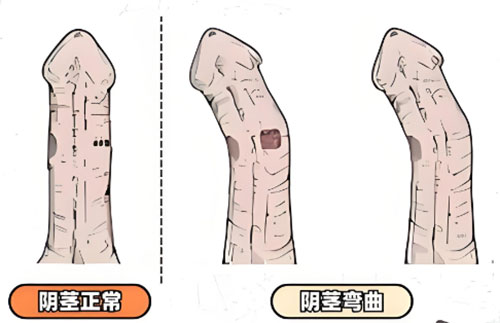 小鸡向左歪了45度怎么矫正