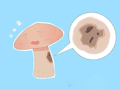 冠状沟有白色的分泌物是什么原因