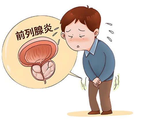前列腺炎做什么运动有助于恢复