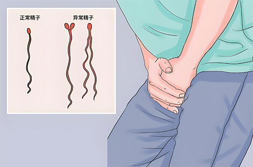 畸形精症可以治愈吗