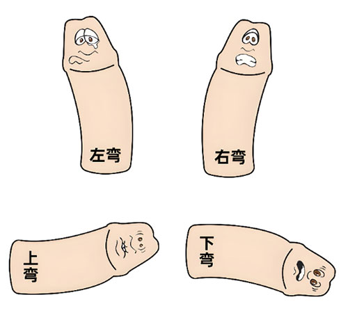 丁丁长得歪是怎么回事