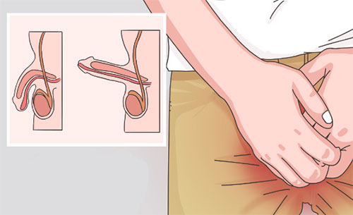 丁丁为什么会向上弯曲