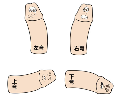 丁丁向下弯曲正常吗