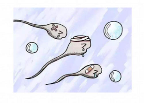 死精症是什么病