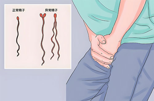 畸形精症可以生孩子吗