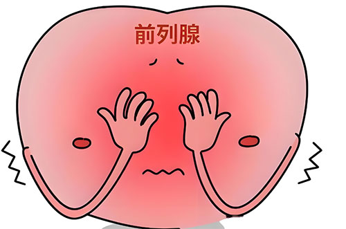前列腺增生怎么治疗