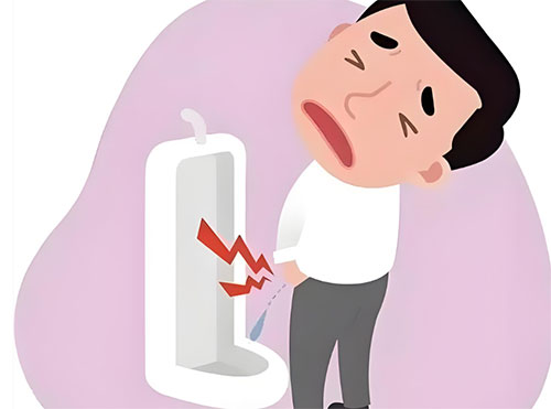 男性尿路感染有什么症状怎么治疗