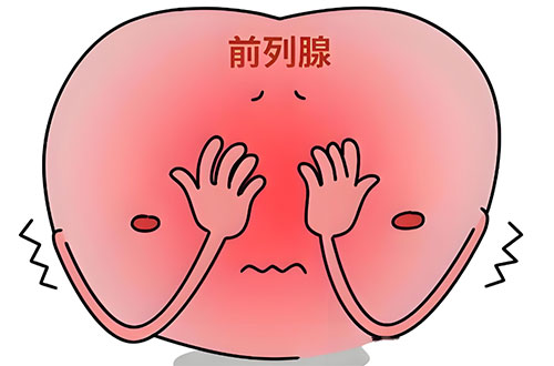 前列腺增生怎么查出来的