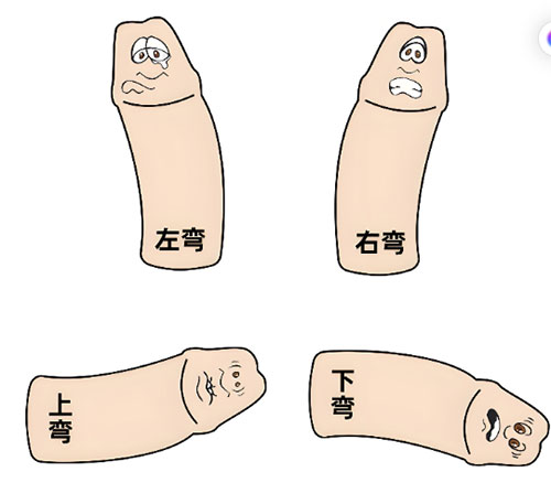 小弟弯了怎么纠正