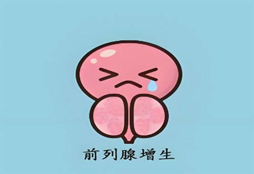 前列腺增生会变成癌吗