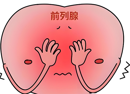 前列腺肥大的原因是什么