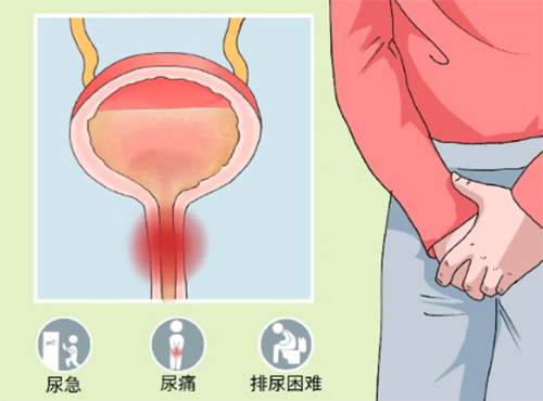男人尿道炎怎么引起的