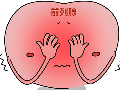 前列腺肥大需要手术吗