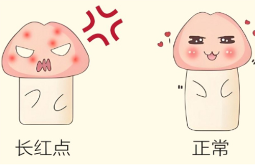 龟头上有小红点怎么治疗