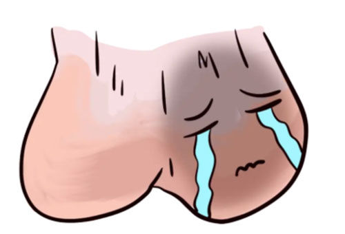 阴囊瘙痒怎么根治好