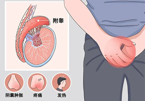 附睾炎怎么引起的