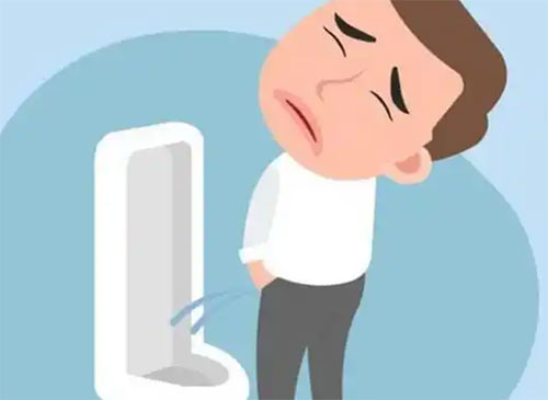 男人尿分叉怎么解决